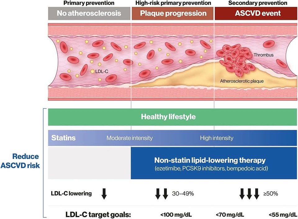 ZHeart11768530's tweet photo. 🔴Evolving Management of Low‐Density Lipoprotein Cholesterol: A Personalized Approach to Preventing ASCVD Across the Risk Continuum #2023Review #openaccess 

🔹https://t.co/3hNZsFgg6E
#CardioTwitter #CardioEd #Lipids #CVrisk #LDL https://t.co/Y8ScdE38bG