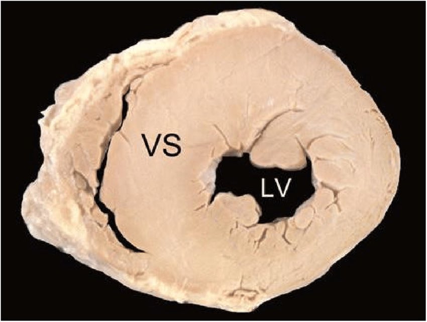 ريان | MD1TALK🌟 tweet media