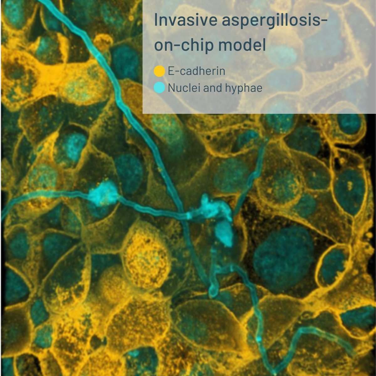 Dynamic42_Jena's tweet image. As part of the @BMBF_Bund funded ATHANA Alliance we’ve developed an invasive aspergillosis-on-chip model. Our lead researcher on this project, Dr. Mai Hoang, is at AMR today to talk about her most recent results. #AMR #AMRconference #organonchip #drugdevelopment