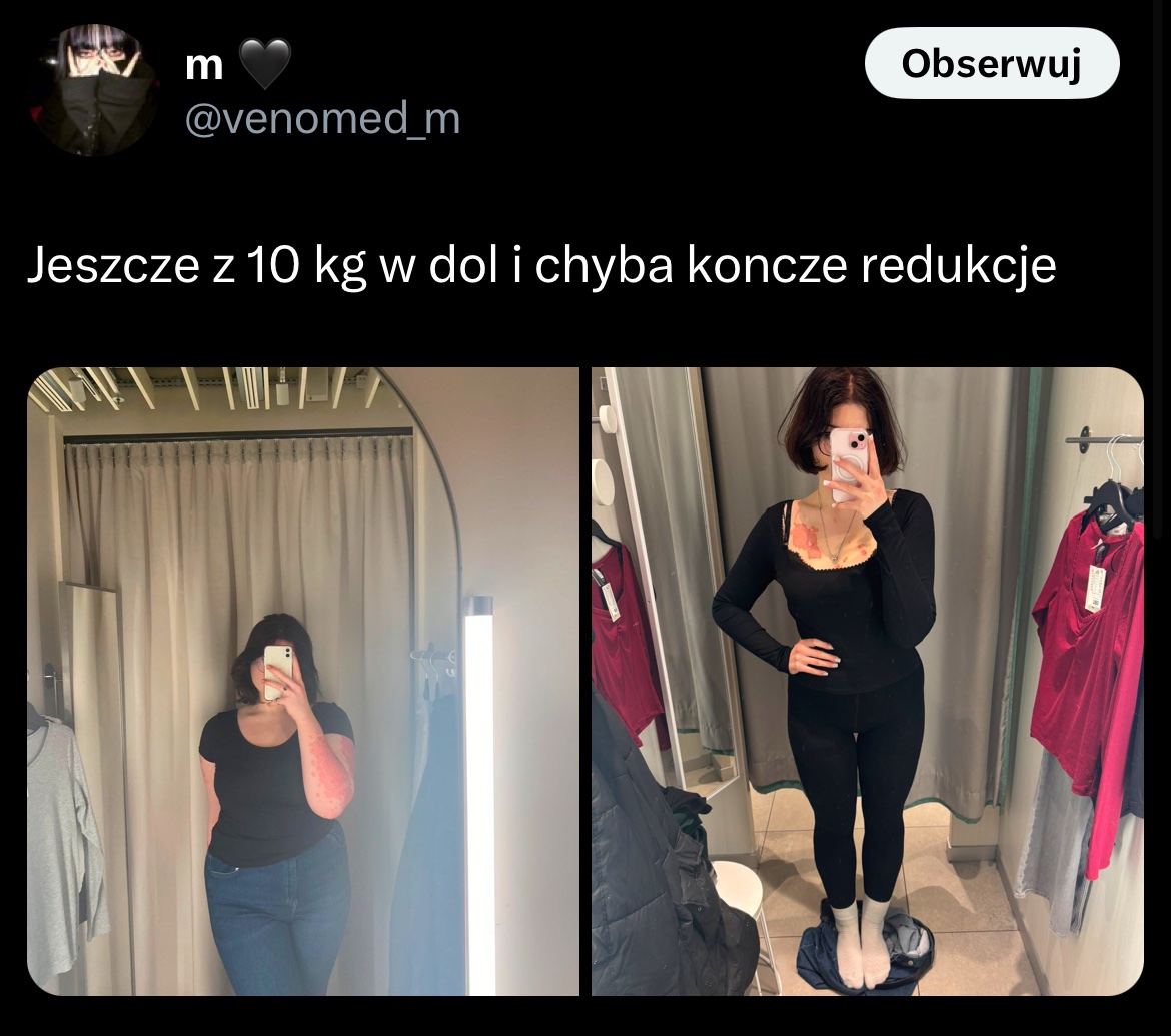 krecikkrol's tweet photo. widzicie grube kurwy? można https://t.co/dKCJCmcPA5