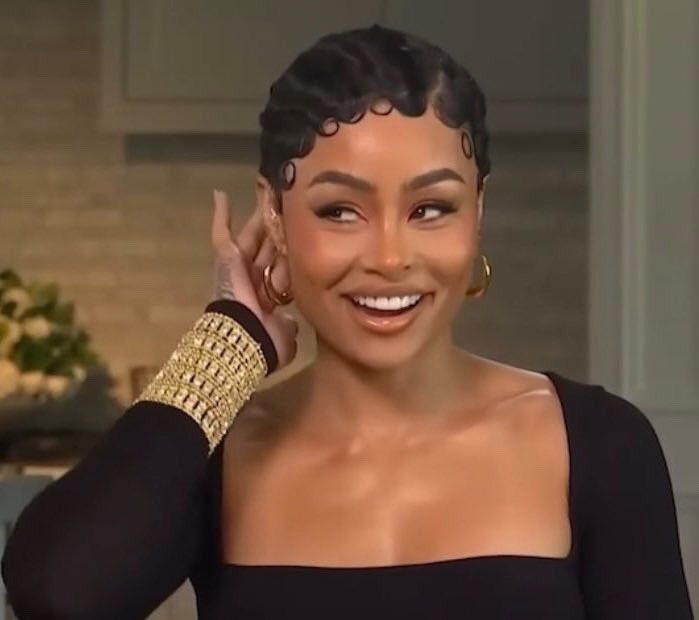 dissolving the fillers was the best decision she ever made 😍