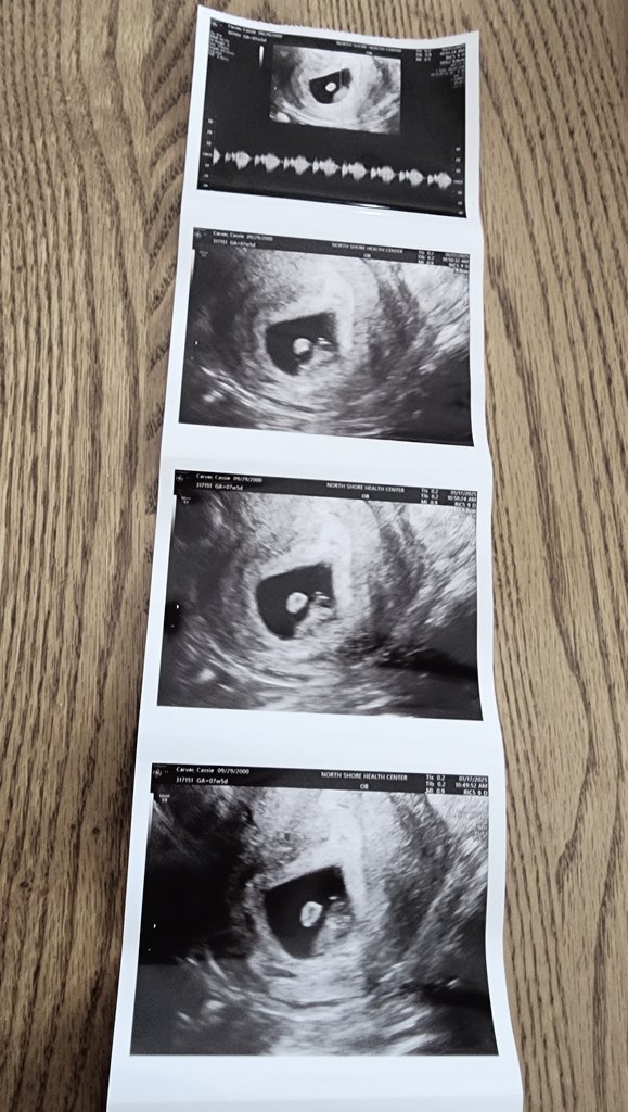 GodBlessRoo's tweet image. IM GOING TO BE A DAD!!!