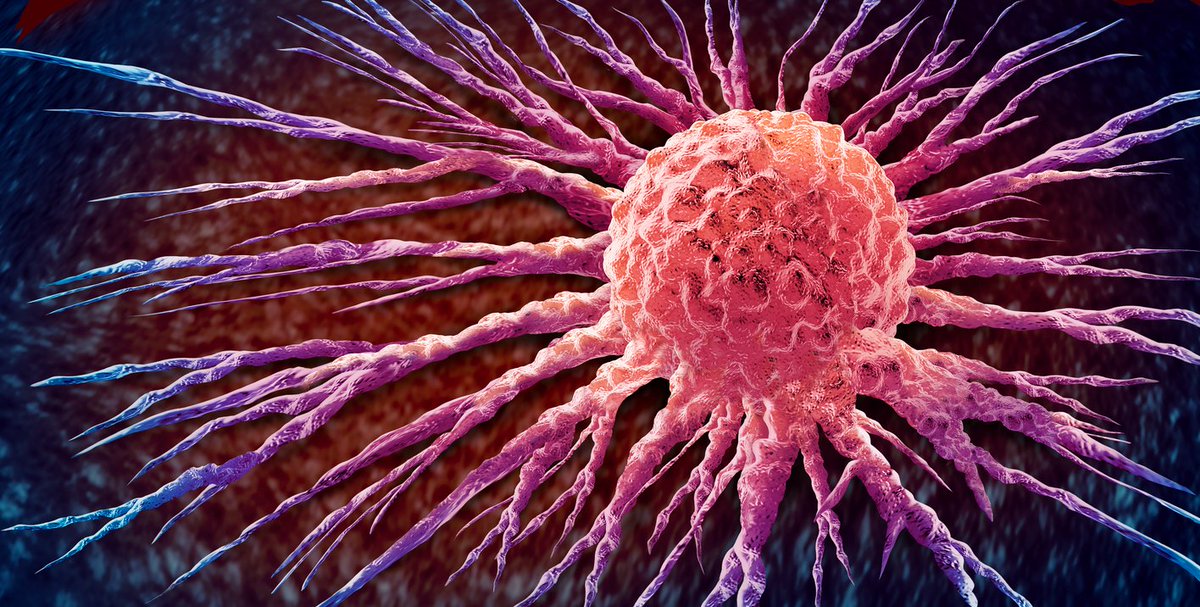 UC San Diego Health Moores Cancer Center (@ucsdcancer) on Twitter photo This <a href="/CR_AACR/">Cancer Research</a> study identifies the overactive gene MICAL2 in deadly pancreatic cancer — linking it to tumor growth, spread, & poor outcomes. 🔍 
MCC's Dr. Pablo Tamayo, Dr. Jill Mesirov, Dr. Herve Tiriac, & Dr. Andrew Lowy explore how the gene is a potential treatment target: This <a href="/CR_AACR/">Cancer Research</a> study identifies the overactive gene MICAL2 in deadly pancreatic cancer — linking it to tumor growth, spread, & poor outcomes. 🔍 
MCC's Dr. Pablo Tamayo, Dr. Jill Mesirov, Dr. Herve Tiriac, & Dr. Andrew Lowy explore how the gene is a potential treatment target: