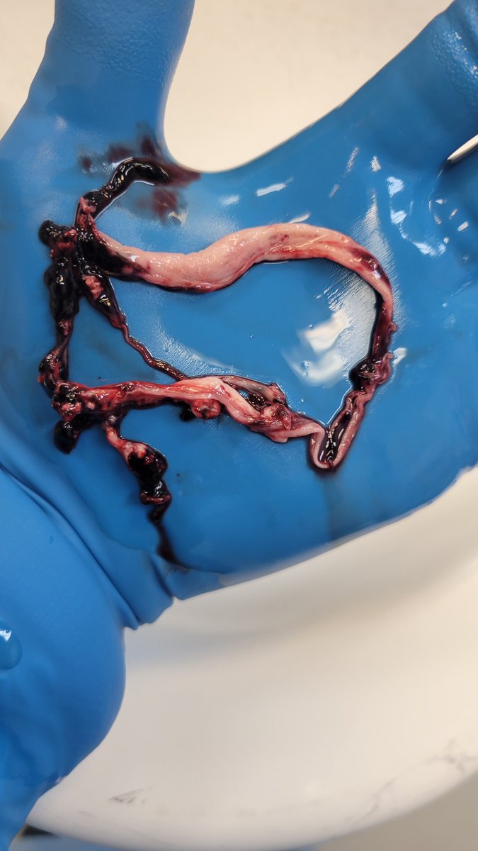 Richard Hirschman tweet media