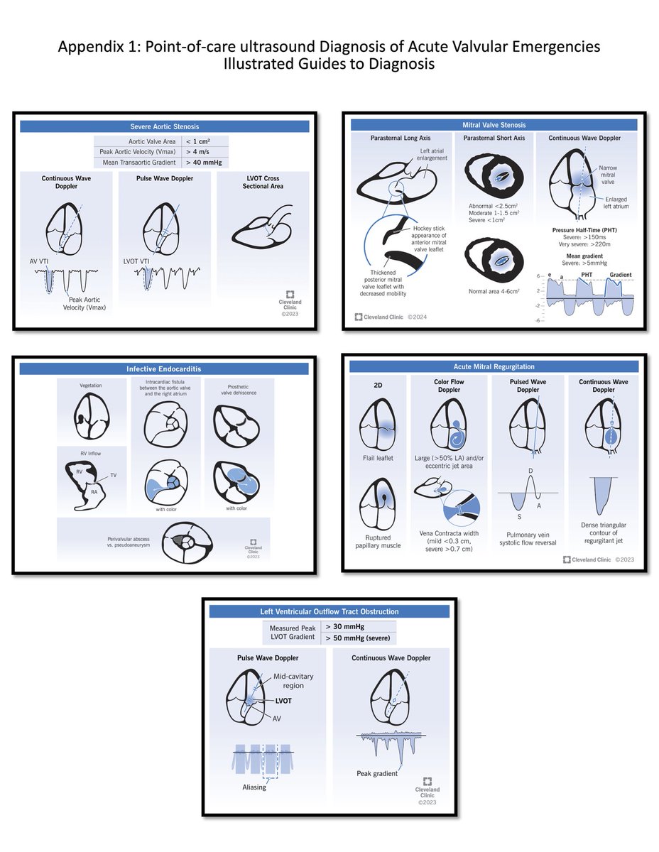 Bob Stenberg (@pocusaurusrex) on Twitter photo #POCUS diagnosis of acute valvular emergencies, highlighting a practical how-to, pocket cards, pearls and pitfalls!
free access until 2/4/25!
<a href="/OhioACEP/">Ohio ACEP</a> <a href="/SAEMAEUS/">SAEM Academy of Emergency Ultrasound (AEUS)</a> <a href="/ACEP_EUS/">ACEP Ultrasound</a> <a href="/CCAG_EM/">CCAG_EM</a> <a href="/ultrasound_vcu/">VCU Ultrasound</a> @SAlerhand <a href="/lataylor1218/">Lindsay Taylor</a> <a href="/mtabbut/">Matt Tabbut, MD</a> <a href="/RubberCitySono/">Rubber City Sono</a>
kwnsfk27.r.eu-west-1.awstrack.me/L0/https:%2F%2⦠#POCUS diagnosis of acute valvular emergencies, highlighting a practical how-to, pocket cards, pearls and pitfalls!
free access until 2/4/25!
<a href="/OhioACEP/">Ohio ACEP</a> <a href="/SAEMAEUS/">SAEM Academy of Emergency Ultrasound (AEUS)</a> <a href="/ACEP_EUS/">ACEP Ultrasound</a> <a href="/CCAG_EM/">CCAG_EM</a> <a href="/ultrasound_vcu/">VCU Ultrasound</a> @SAlerhand <a href="/lataylor1218/">Lindsay Taylor</a> <a href="/mtabbut/">Matt Tabbut, MD</a> <a href="/RubberCitySono/">Rubber City Sono</a>
kwnsfk27.r.eu-west-1.awstrack.me/L0/https:%2F%2ā¦