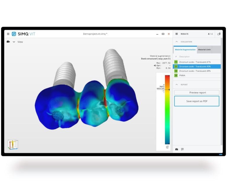 3dheals's tweet image. My previous career was in clinical studies, and my current position at Simq introduced me to personalized implants and the medical 3D printing world.

Read more 👉 lttr.ai/ARqea

#simq #Medical3Dprinting #Bioprinting #3Dprint #dental3dprinting