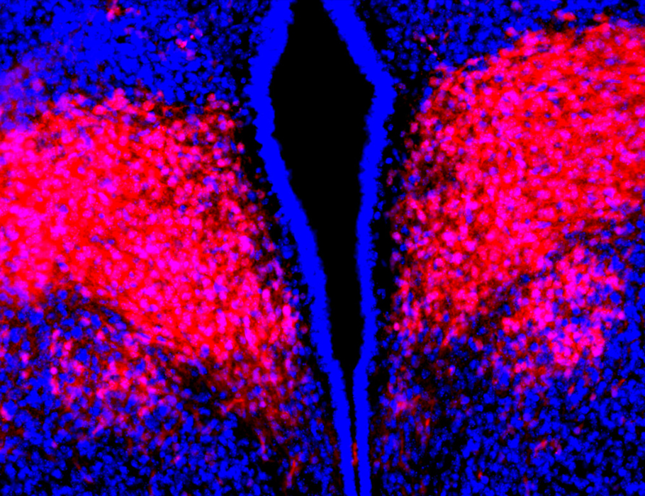 Science Translational Medicine (@sciencetm) on Twitter photo Rare mutations in the transcription factor #Orthopedia cause early-onset #obesity by suppressing the melanocortin 4 receptor in the hypothalamus, shows research involving mice and UK Biobank data. <a href="/ChenLiuLab/">Chen Liu</a> <a href="/Farooqi_Lab/">Farooqi Lab</a> <a href="/UTSWInternalMed/">UTSW Internal Medicine</a> <a href="/Baijie_Xu/">Baijie</a> scim.ag/40hZulf Rare mutations in the transcription factor #Orthopedia cause early-onset #obesity by suppressing the melanocortin 4 receptor in the hypothalamus, shows research involving mice and UK Biobank data. <a href="/ChenLiuLab/">Chen Liu</a> <a href="/Farooqi_Lab/">Farooqi Lab</a> <a href="/UTSWInternalMed/">UTSW Internal Medicine</a> <a href="/Baijie_Xu/">Baijie</a> scim.ag/40hZulf