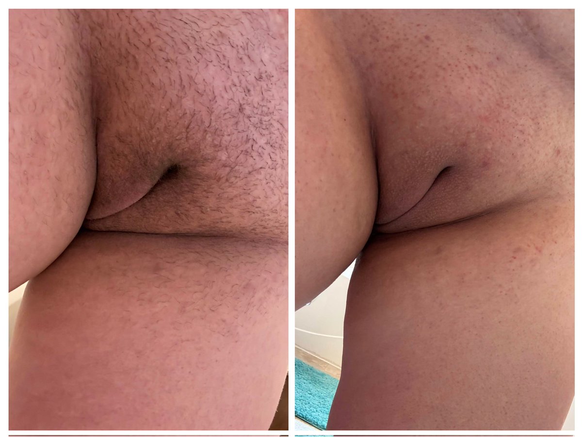 Which do you like better?!?!
Like for hair, Retweet for smooth shave