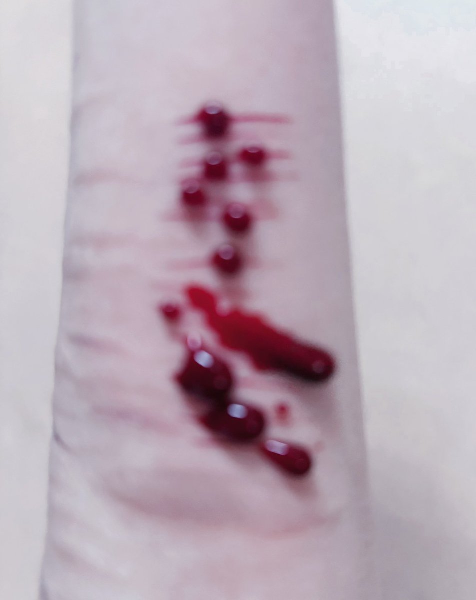 Misakaaa0502's tweet photo. 最整齐的一集🥹11号🔪🥹

#自殘 #自傷 #自傷行為 #紫餐 #抑郁症 #selfharm #sh #shtwt https://t.co/LlE8pIIdHG