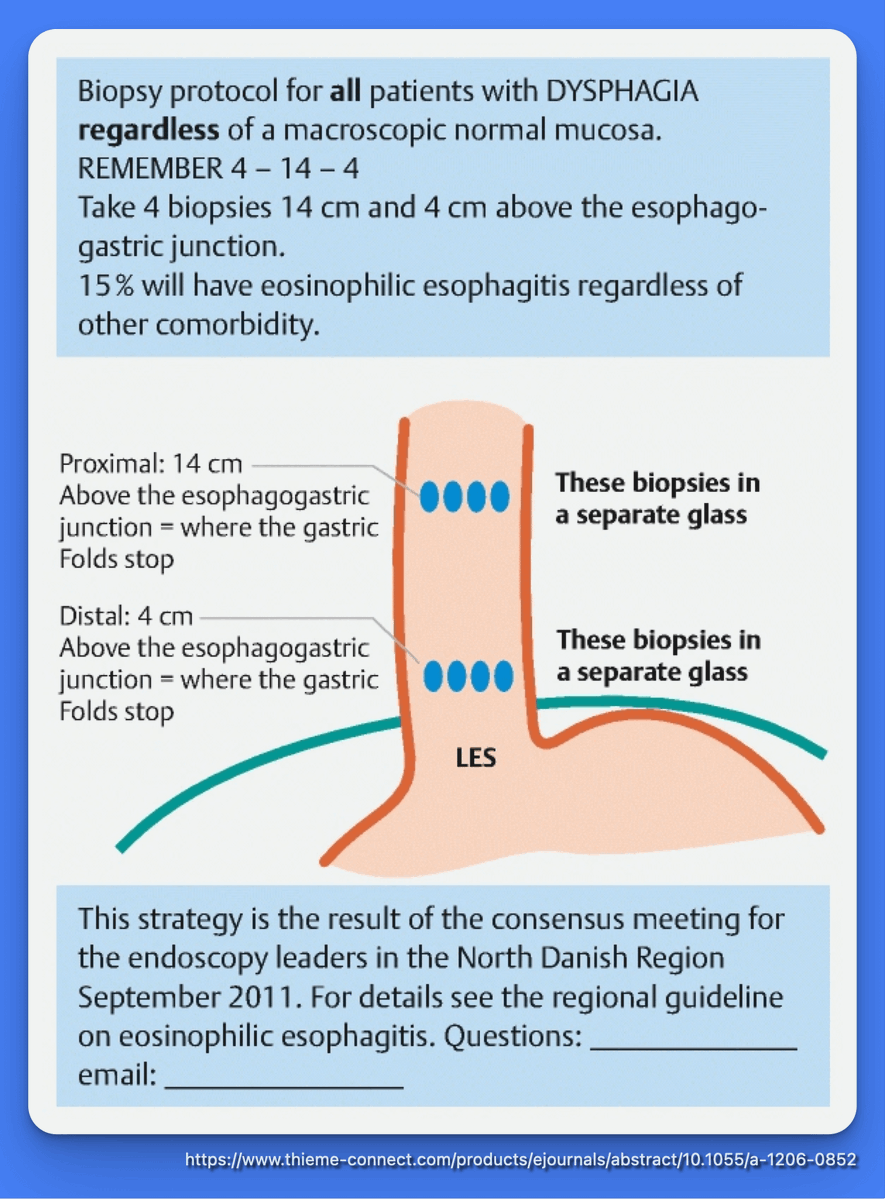 Biopsy Protocol for Dysphagia: Don't Miss Eosinophilic Esophagitis

This infographic highlights a key biopsy protocol:

All patients with dysphagia should undergo biopsy, regardless of whether the esophageal mucosa appears normal.

Remember the 4-14-4 rule: 4 biopsies at 14 cm