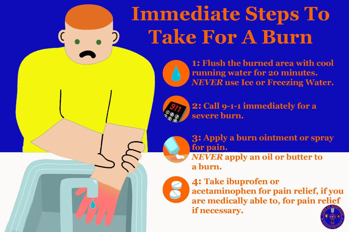 ChesterfieldPIO's tweet photo. Immediate Steps To Take For A Burn

#MTVCT #Montville #MontvilleCT #CT #Connecticut #FirstAid https://t.co/WRLxgD121v