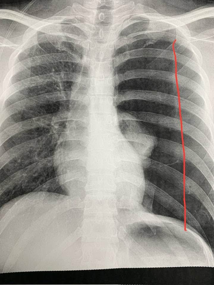 TonyToni tweet media