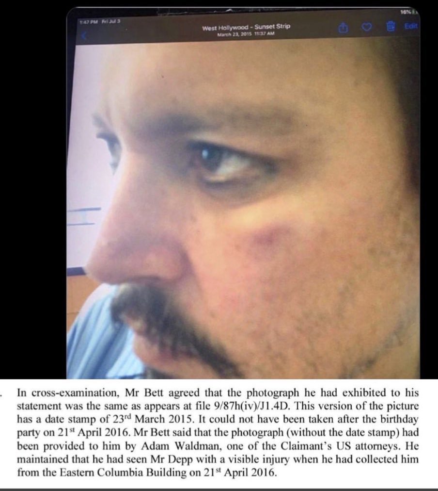 Babette (@twtdetective) on Twitter photo <a href="/nannselm/">piisamirotta</a> <a href="/StarowNiklas/">Nik Starow</a> <a href="/KattN0tWilliams/">Katt</a> Another incident Depp lied about was his claim that Amber punched him after her 4/21/16 birthday dinner. But to prove it, he used a photo from 3/23/15 when Amber admittedly punched him after discovering he was cheating on her. He was forced to admit the birthday story was false. <a href="/nannselm/">piisamirotta</a> <a href="/StarowNiklas/">Nik Starow</a> <a href="/KattN0tWilliams/">Katt</a> Another incident Depp lied about was his claim that Amber punched him after her 4/21/16 birthday dinner. But to prove it, he used a photo from 3/23/15 when Amber admittedly punched him after discovering he was cheating on her. He was forced to admit the birthday story was false.