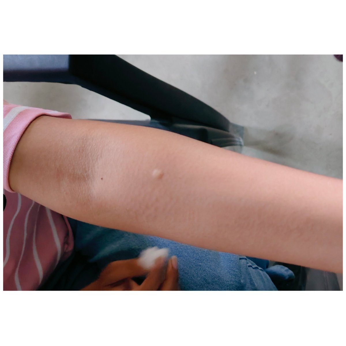 Kinjal161's tweet photo. .
CY TB TEST 
AAM kera (phc kera)
#Tbharegadeshjitega
#tbmuktbharat
#tbtest
@TBHDJ @TbKutch https://t.co/apBZAlmtTs