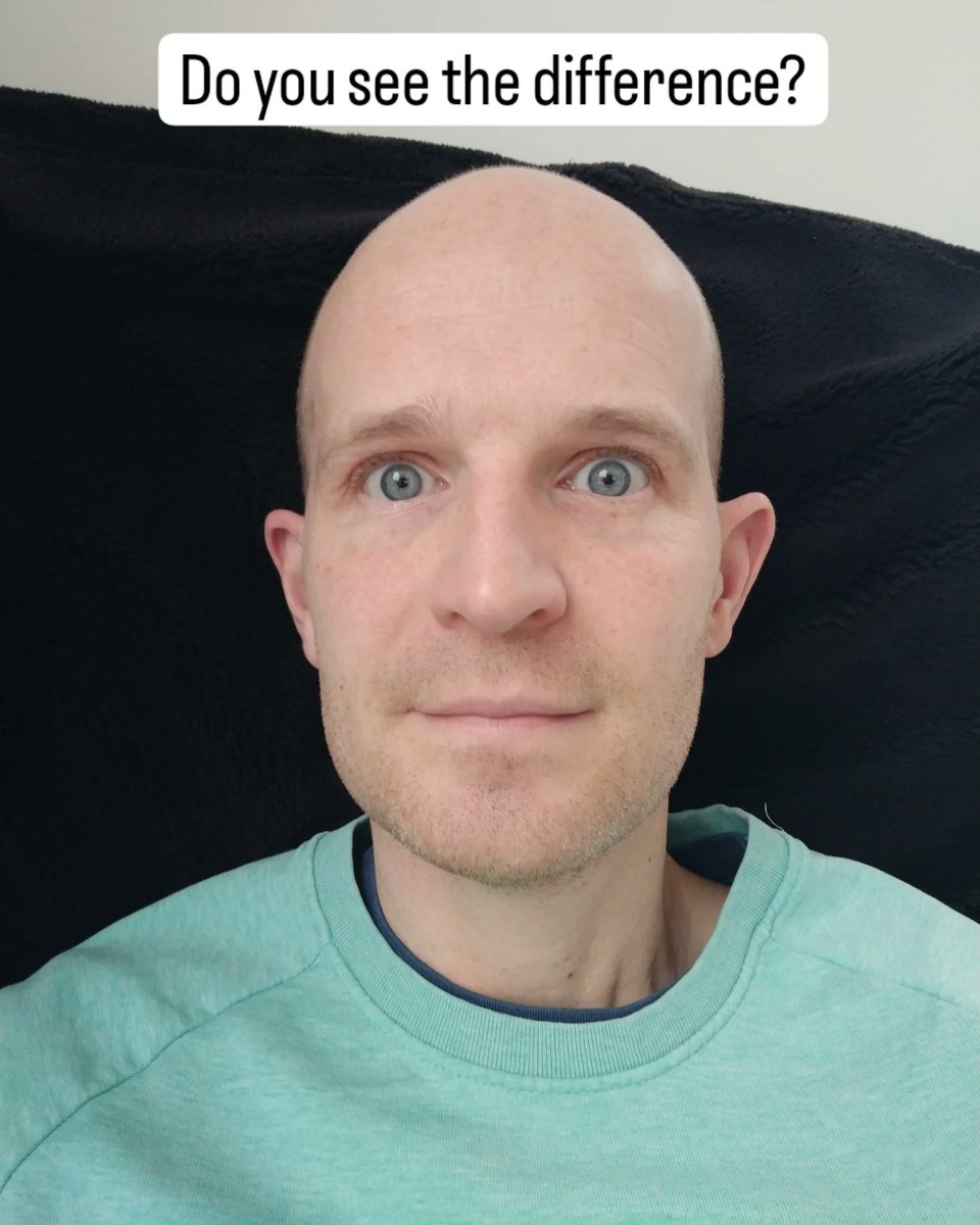 mklilley's tweet photo. It's all in the eyes! I recently listened to  @vvanedwards on the DOAC podcast who said the more white we show at the top of our eyes, the more scared we look. The difference is so clear to us even though it's only a subtle change in the whiteness we show. The brain is amazing! https://t.co/yZOu9V4Erl