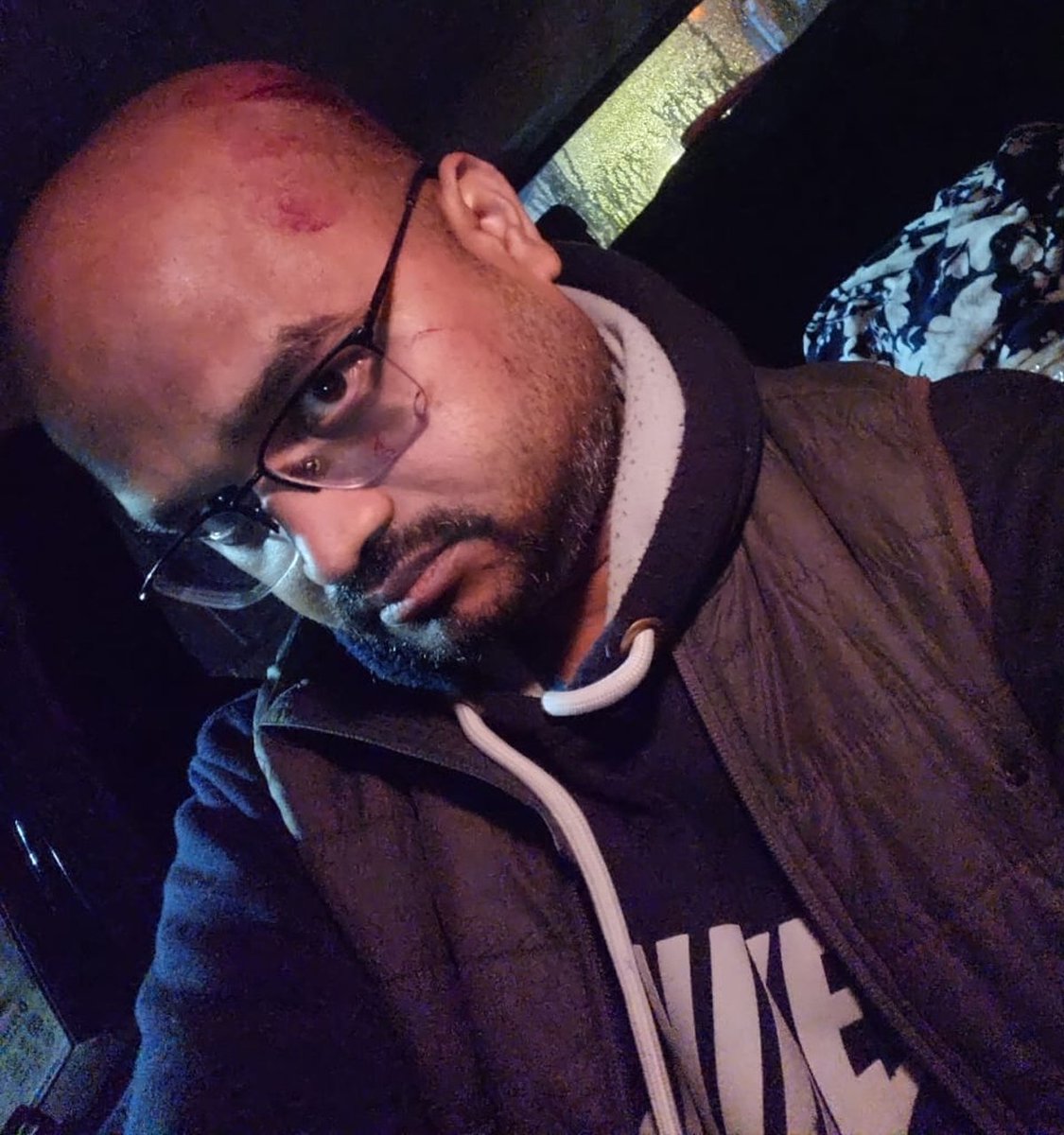 NCMIndiaa's tweet image. Indian Men are not safe inside their own home.
Shyam from Jaitpur (Near Badarpur, Delhi) was brutally assaulted by his wife and Brother in Law last night. When he went to Jaitpur Police Station they simply asked him to go to AIIMS  Trauma Centre to get his MLC and treatment done.…