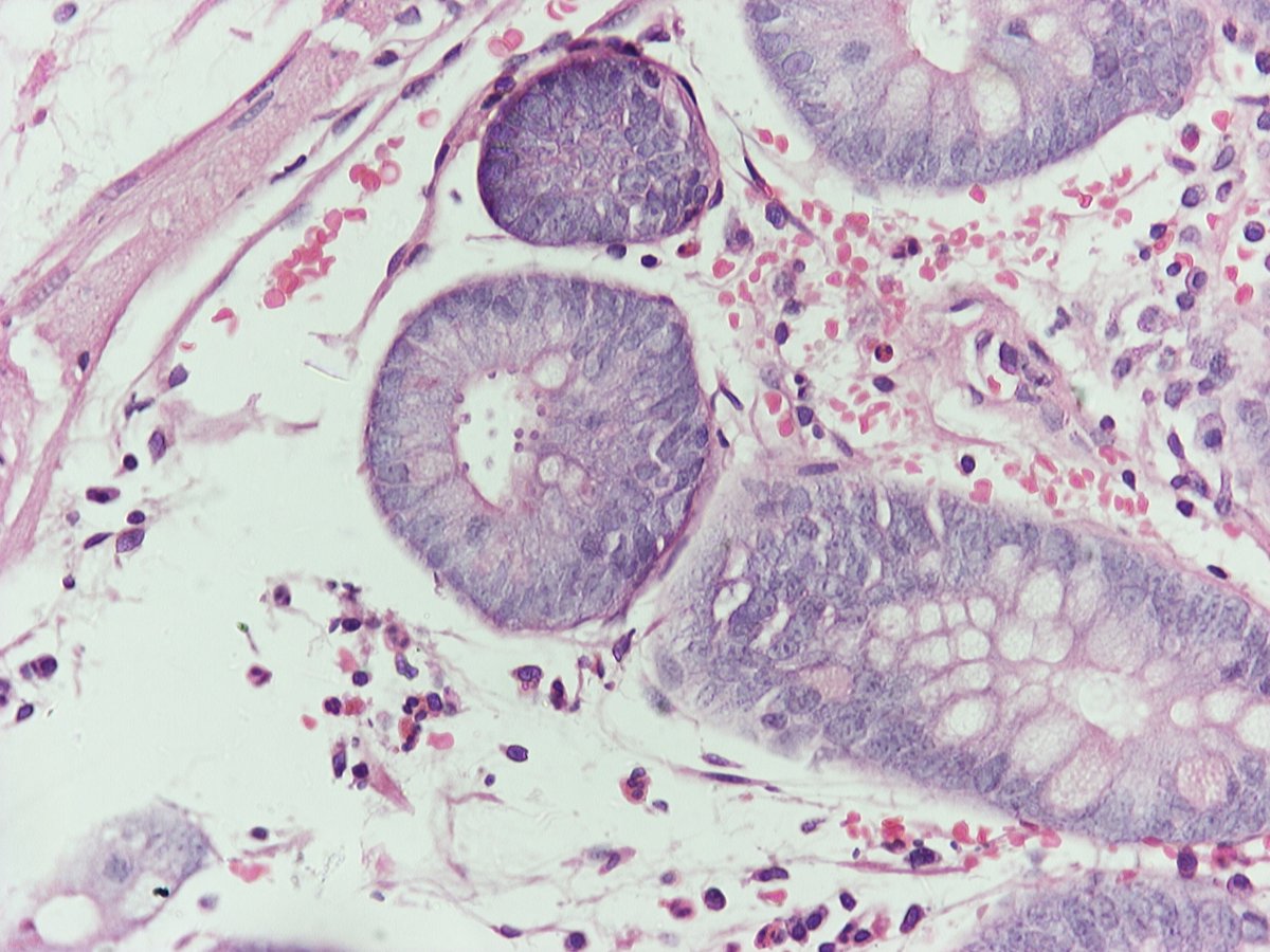 European Society of Pathology (ESP) tweet media