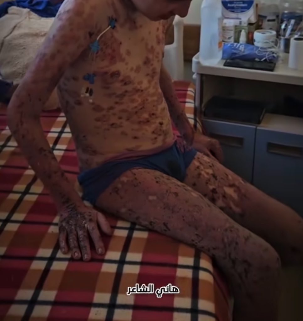 If you see this pic, reply with 🇵🇸 spread it 💔