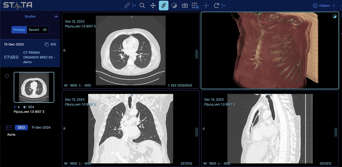 Če koga zanima oblačni PACS, smo postavili demo verzijo na: demo-pacs.stata.si (u: demo, g: demo123). Ogled priporočljiv z računalnikom. Tak PACS lahko nadomešča bolnišnične PACSe, ki so zaprti in imajo zato svoje omejitve.