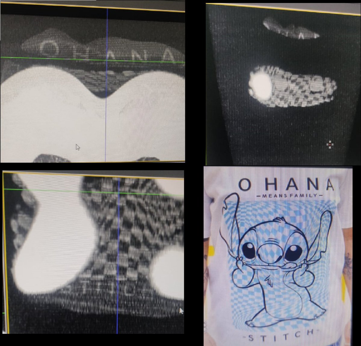 Much is said about radiomics and texture analysis. When did we forget about textile analysis? #radiology