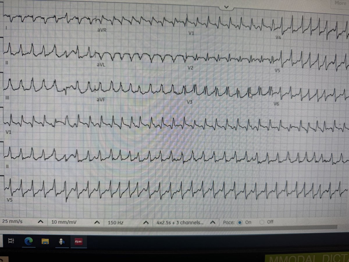 50 year old with this 
#epeeps