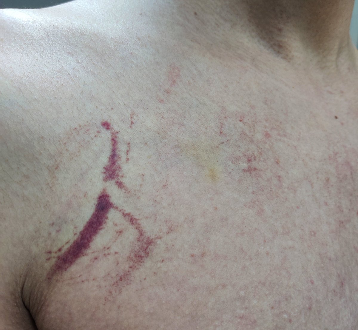 dm_suby's tweet image. 我的遍体鳞伤，是你留给我的最美印记

#男m #女s #踩踏 #恋足 #踩射 #鞋底 #上海 #调教 #现实 #女王 #踢裆 #乘骑 #舔鞋 #狗奴 #鞋印 #sm #女主