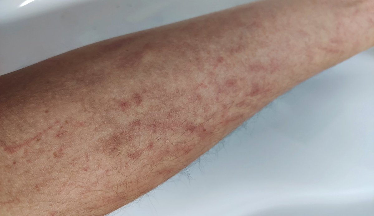 dm_suby's tweet image. 我的遍体鳞伤，是你留给我的最美印记

#男m #女s #踩踏 #恋足 #踩射 #鞋底 #上海 #调教 #现实 #女王 #踢裆 #乘骑 #舔鞋 #狗奴 #鞋印 #sm #女主