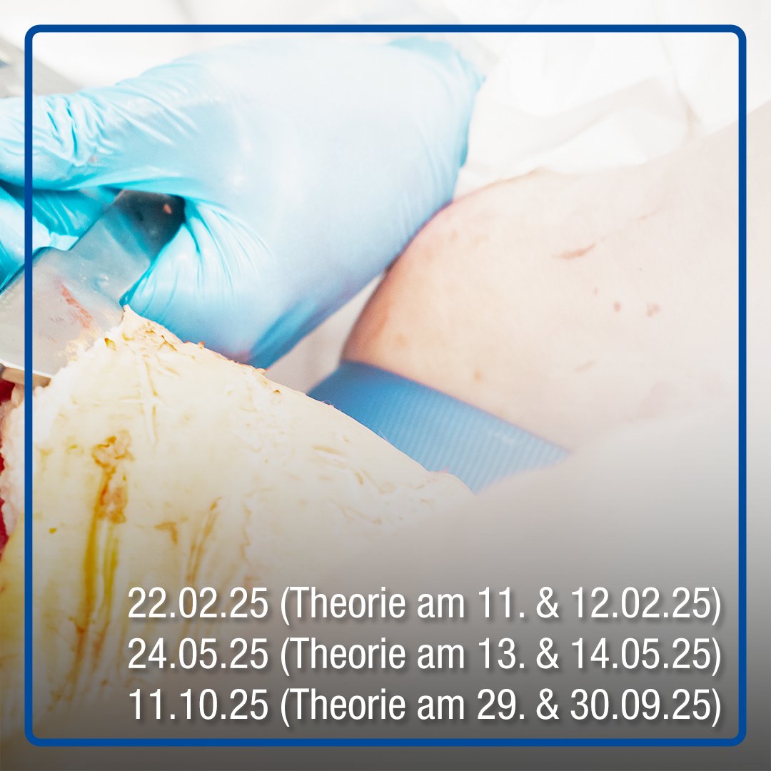 Der Kurs zur Notfallthorakotomie bereitet dich auf einen der anspruchsvollsten Eingriffe in der Notfallmedizin vor: den traumatischen Herz-Kreislauf-Stillstand. 

Infos unter: medi-learn.de/pert 

#medilearn #notfallmedizin #PERT #düsseldorf #medizinischelehre #fortbildung