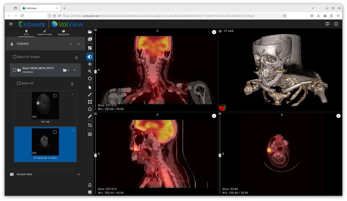 New release 1.2 of the VolView plugin for Orthanc is now available! This release ships <a href="/Kitware/">Kitware</a> VolView 4.3.0 (even though its "About" box displays 4.2.0). #DICOM
➡️ orthanc.uclouvain.be/book/plugins/v…
