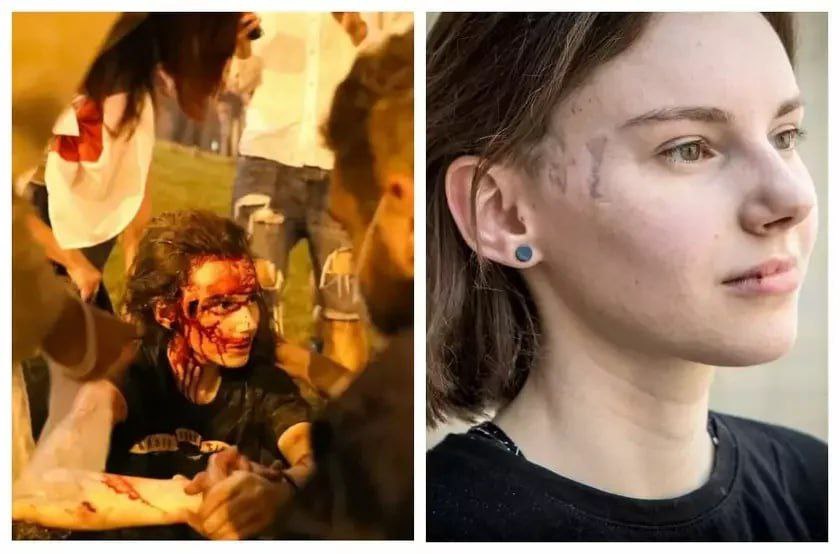 💔 Maria Zaitseva was wounded by a stunt grenade during 2020 protests in Minsk.
When the invasion started, she joined the second international legion. At first as a medic, later as an effective sniper. 
Unfortunately, at 24 years of age, she fell on the battlefield near Pokrovsk.