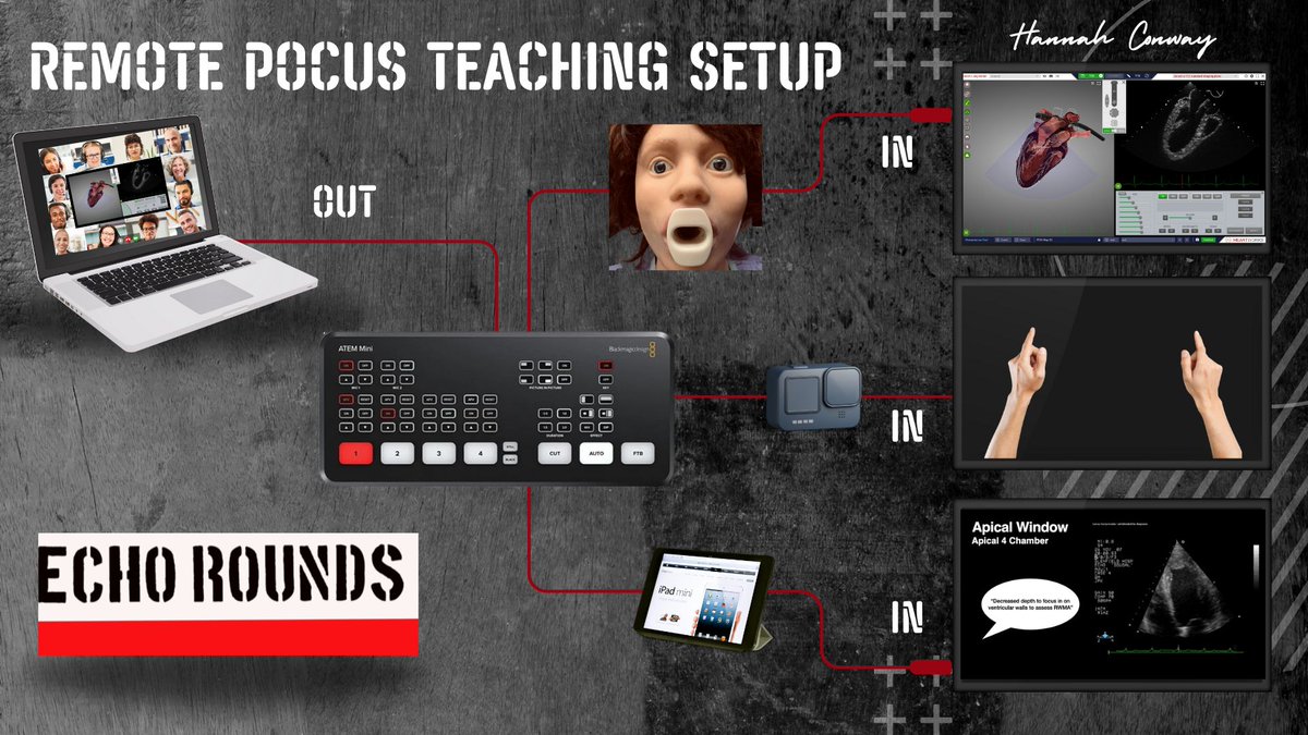ghcritcareecho's tweet image. 🔊 New blog: &quot;Revolutionising Remote PoCUS Education&quot; - From local Echo Rounds to global ultrasound teaching across 3 continents. See how we&apos;re transforming medical education with virtual solutions &amp;amp; cutting-edge tech. Full guide here: buff.ly/4fZgmD6 #POCUS #MedEd