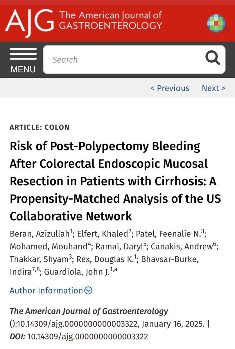 Azizullah Beran, MD, ABOM-D (@azizullahberan) on Twitter photo Check out our latest paper about risk of post-EMR bleeding in cirrhosis, just published <a href="/AmJGastro/">AJG - The American Journal of Gastroenterology</a> <a href="/AmCollegeGastro/">ACG</a> <a href="/Rex_colonoscopy/">Douglas K. Rex, MD</a> <a href="/JohnGuardiolaMD/">John Guardiola</a> <a href="/ShyamTMD/">Shyam Thakkar, MD</a> <a href="/ElfertKhaled/">Khaled Elfert</a> <a href="/DarylRamai/">Daryl Ramai, MD, MPH, MSc.</a> <a href="/MouhandMD/">Mouhand Mohamed, MD, MSc</a> <a href="/AndrewCanakis/">Andrew Canakis</a>
<a href="/IUGastro/">Indiana University Gastroenterology and Hepatology</a> #GITwitter
See the paper below: Check out our latest paper about risk of post-EMR bleeding in cirrhosis, just published <a href="/AmJGastro/">AJG - The American Journal of Gastroenterology</a> <a href="/AmCollegeGastro/">ACG</a> <a href="/Rex_colonoscopy/">Douglas K. Rex, MD</a> <a href="/JohnGuardiolaMD/">John Guardiola</a> <a href="/ShyamTMD/">Shyam Thakkar, MD</a> <a href="/ElfertKhaled/">Khaled Elfert</a> <a href="/DarylRamai/">Daryl Ramai, MD, MPH, MSc.</a> <a href="/MouhandMD/">Mouhand Mohamed, MD, MSc</a> <a href="/AndrewCanakis/">Andrew Canakis</a>
<a href="/IUGastro/">Indiana University Gastroenterology and Hepatology</a> #GITwitter
See the paper below: