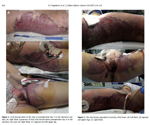 Inglaterra y Finlandia eliminaron los programa de afirmación de género porque no hay evidencia de los beneficios y los riesgos superan cualquier beneficio. Pero si quieres más pruebas mira esto y me dices si esto es bueno para un niño. 

michaeldcastro.blogspot.com/2021/12/una-lo…
