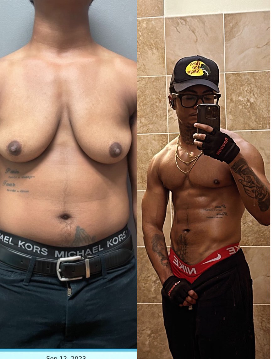 transdaddy23's tweet photo. Progress 🏳️‍⚧️ https://t.co/ZwIfwHRxDo