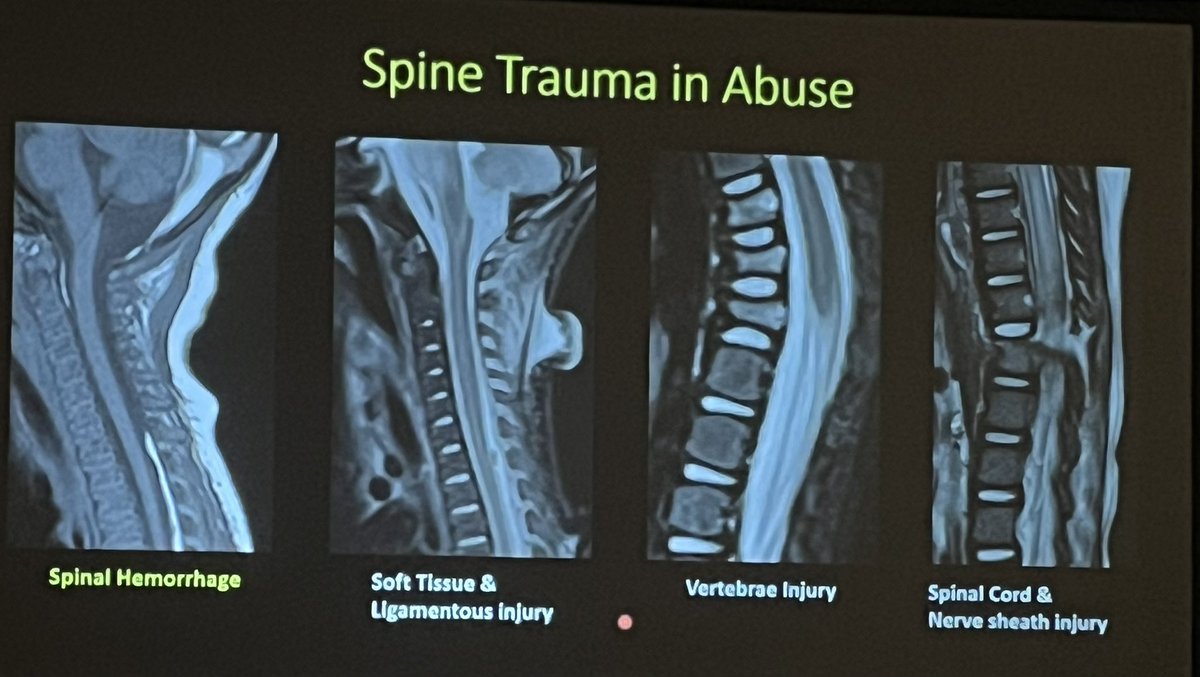 American Society of Pediatric Neuroradiology tweet media
