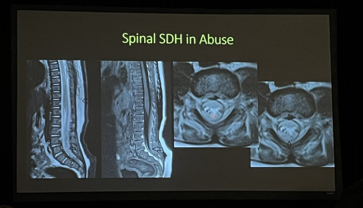 American Society of Pediatric Neuroradiology tweet media