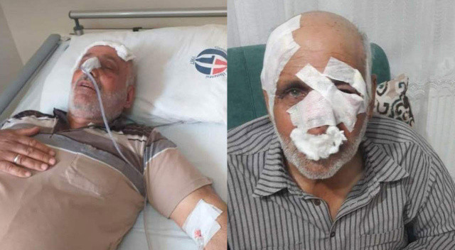 alitufekcii's tweet photo. Neler olmuştu?

Gaziantep'te başıboş sokak köpeklerinin saldırısına uğrayan 72 yaşındaki Mustafa Topal, yaklaşık 2 aydır tedavi gördüğü hastanede hayatını kaybetmişti.

Eşinin ise aynı saldırıda yaralandığı öğrenildi.

#KöpekTerörü https://t.co/ElUoJRmicD