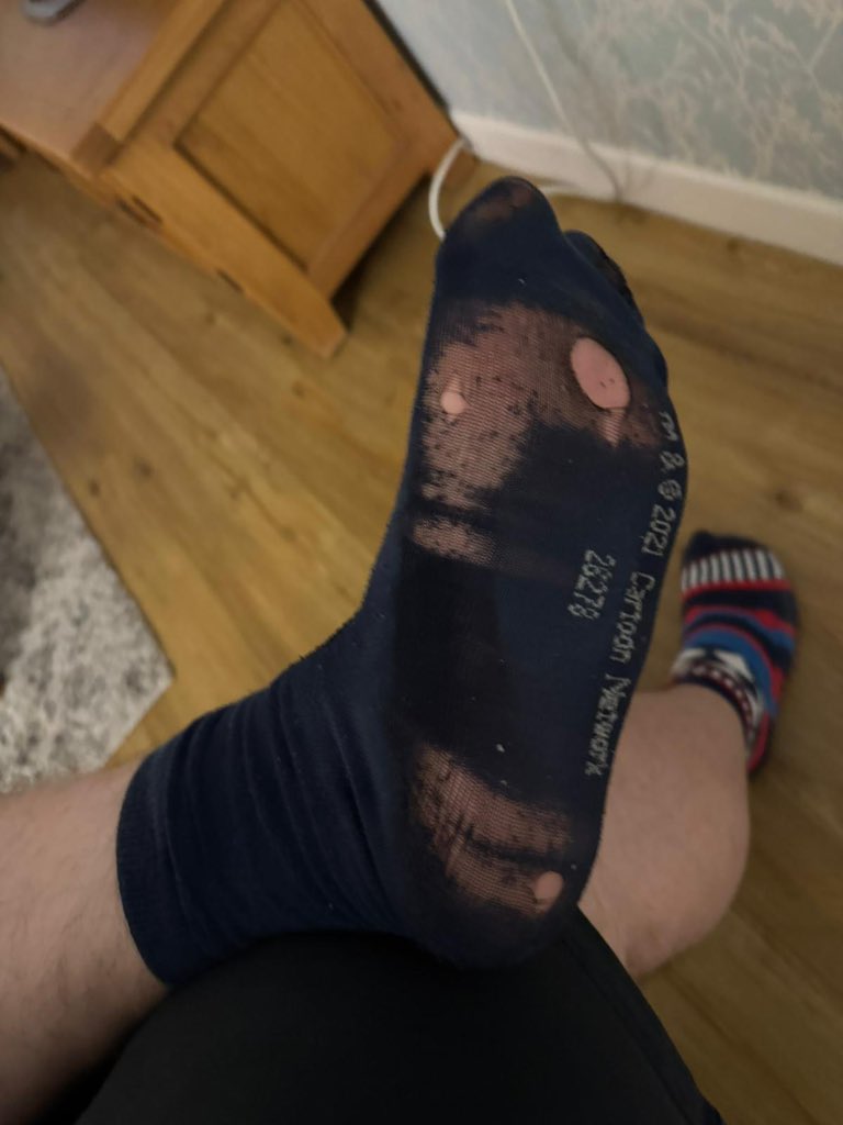Time to bin the socks