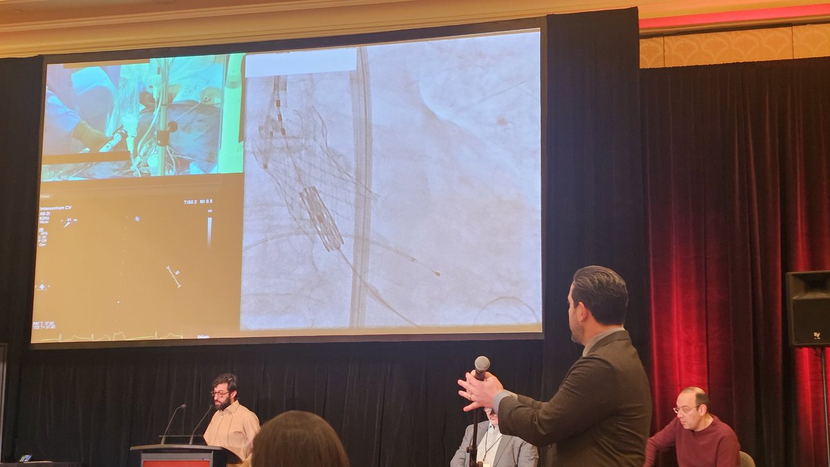 WallyOmarMD's tweet image. Had an amazing time at the @OPCILive structural complications course, learning how tips and tricks to get out of some seriously sticky situations.
Thank you to @jamiemccabeMD @DrBillLombardi @CathElectroSurg
@JasonFoerst @RhianEDavies1 @jeremyrier @CJChungMD