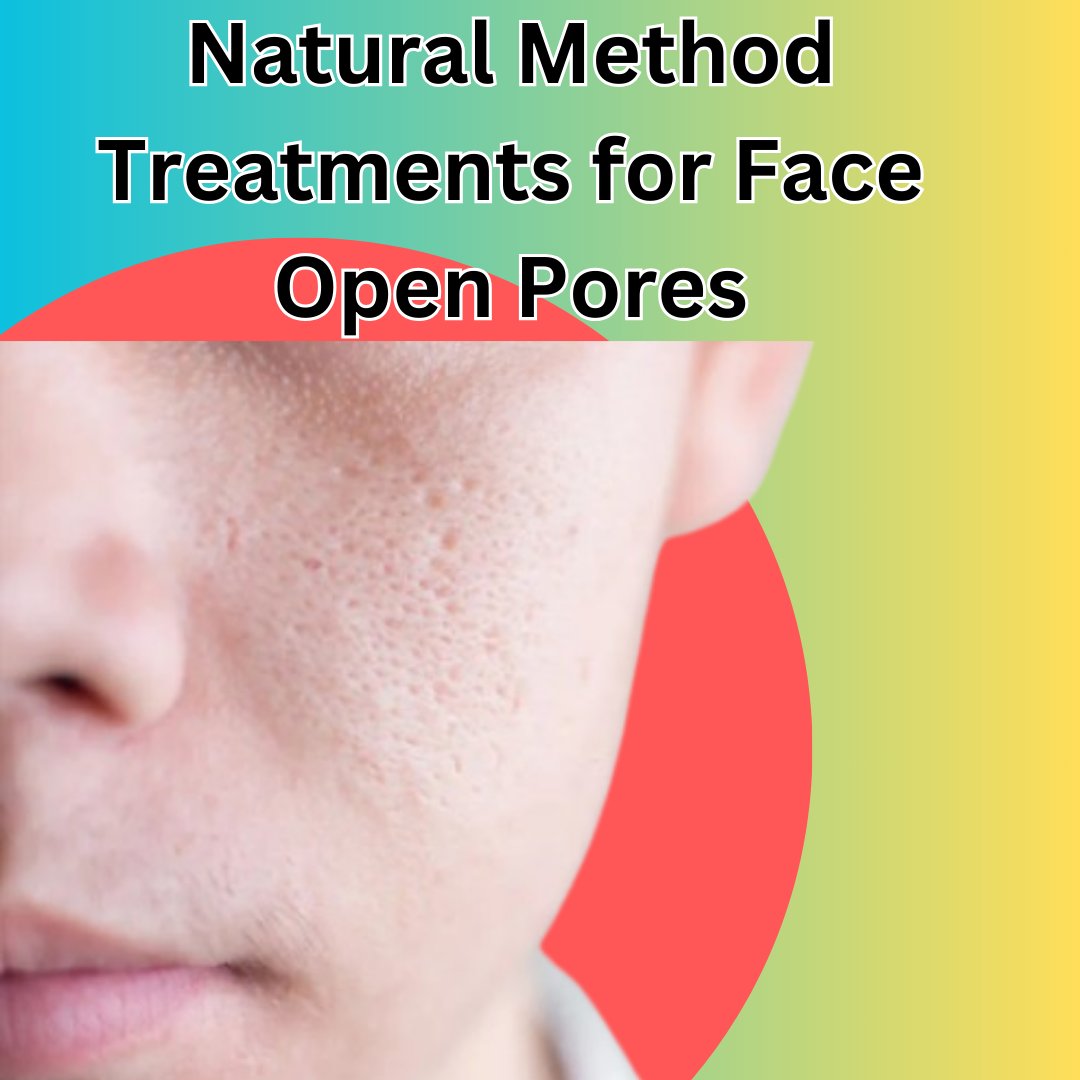 GlowingSec's tweet photo. Natural Method Treatments for Open Pores on the Face

See More Details 👇
https://t.co/an9ErQS9uI...

#Howtoreduceopenporesnaturally #openporestreatment #openpores #Openporetreatmentathome #faceskincare https://t.co/HYHitIDRze