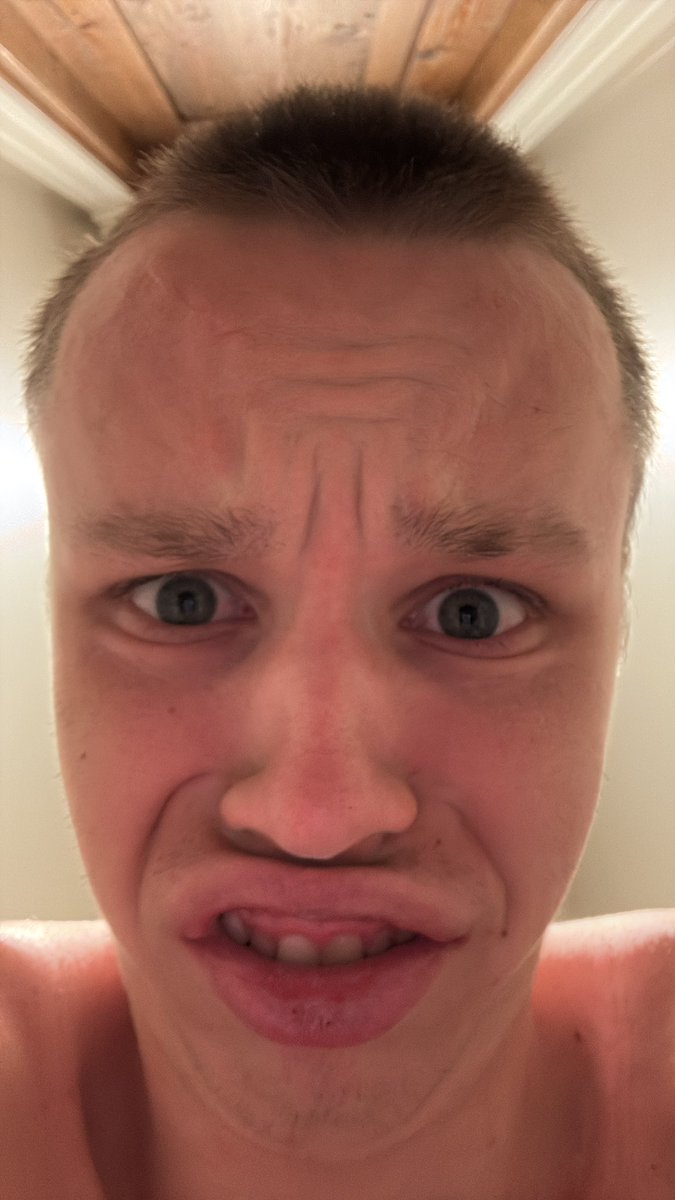 Whoever banned tiktok watch your back you now have the aidster as an opp