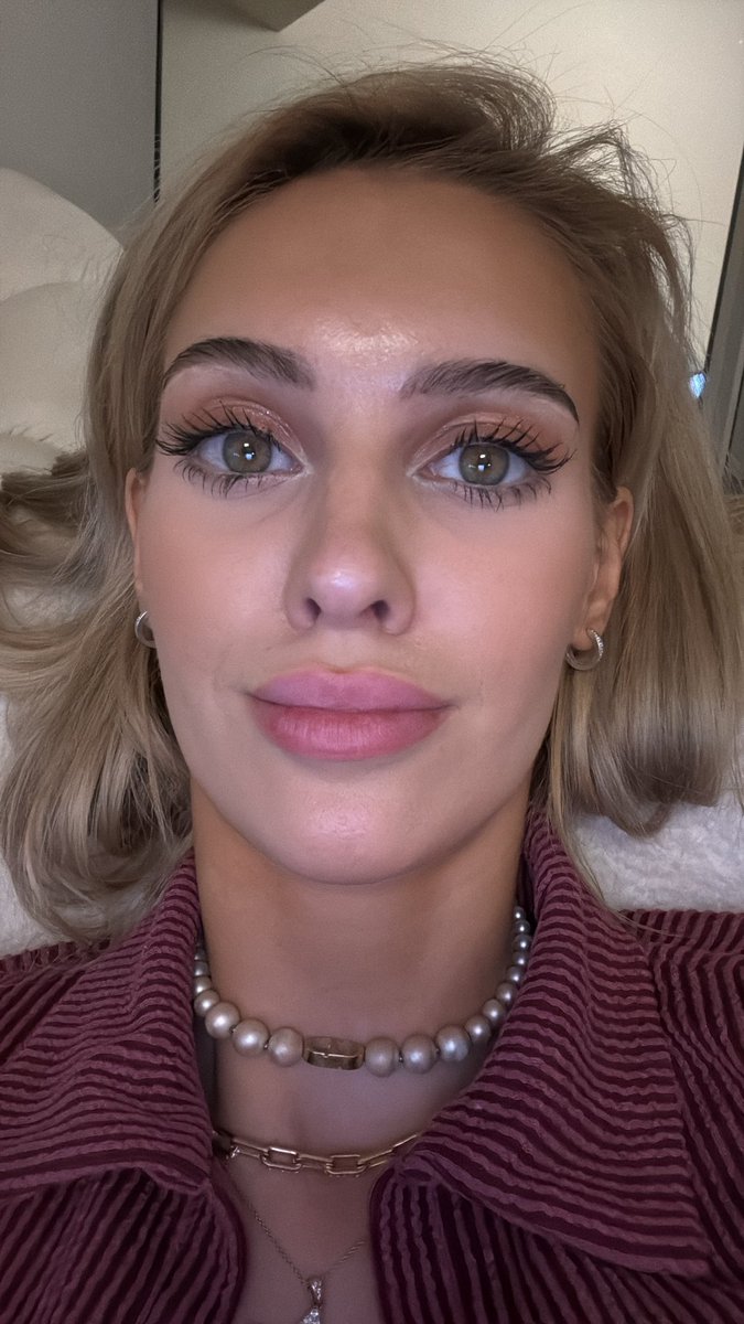So many people addicted on tiktok omg … X much better