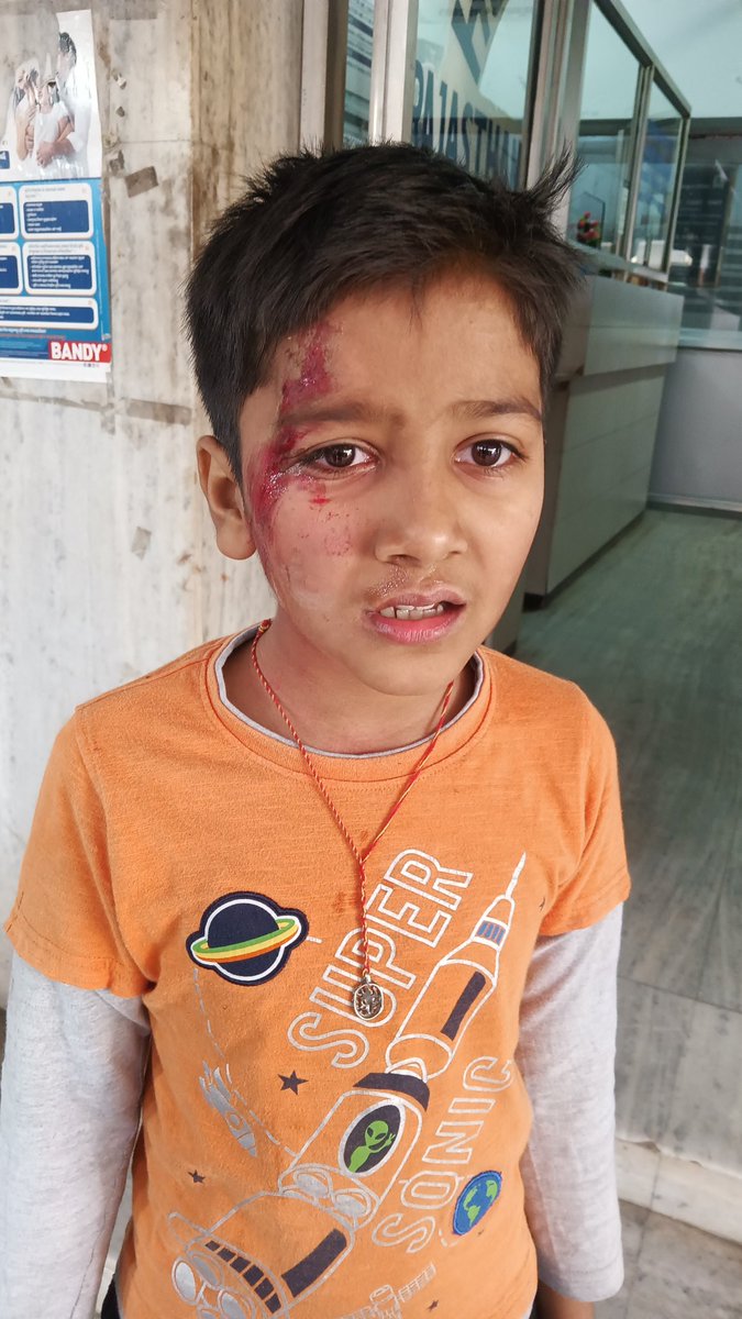 RourkelaVIKASH's tweet photo. @MohanMOdisha My kid was attacked by stray dogs at basanti colony rourkela this afternoon. A big failure of RMC. https://t.co/3O33CmgHS8