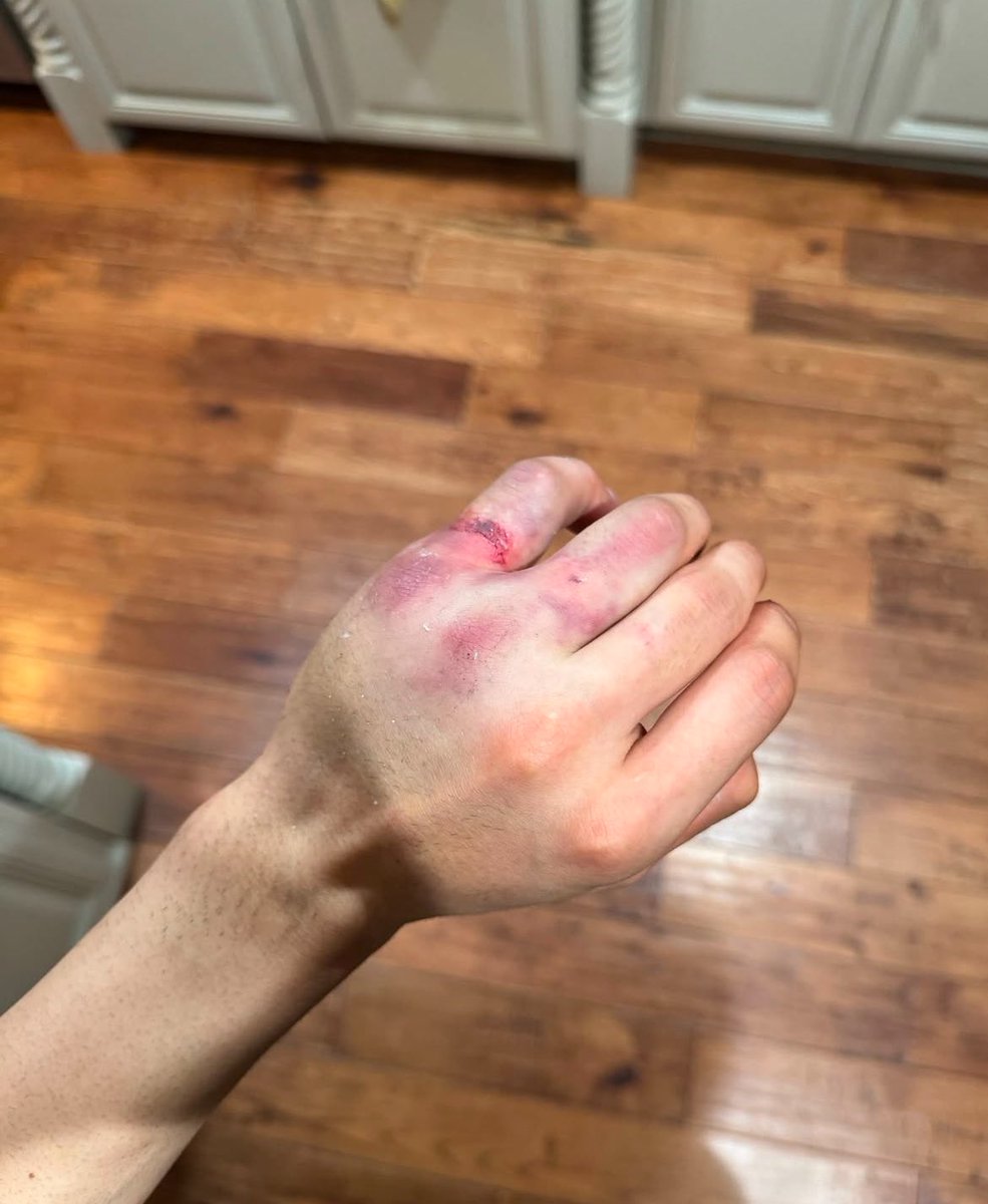 Jo Shimoda fingers after Pit Board incident!