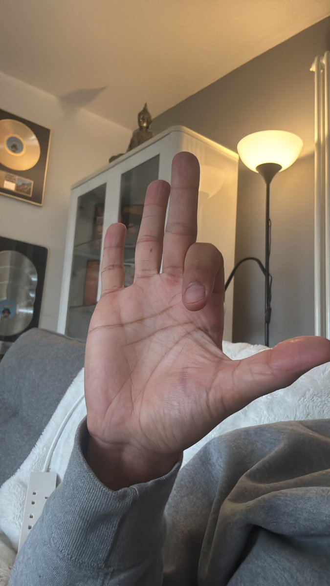 IAMBRU_UK's tweet photo. Put a finger down if you left your car unlocked n ur wallet in there n someone robbed all your cards and also your season tickets so you have to watch forest at home like a twat https://t.co/Zr31akKT4D