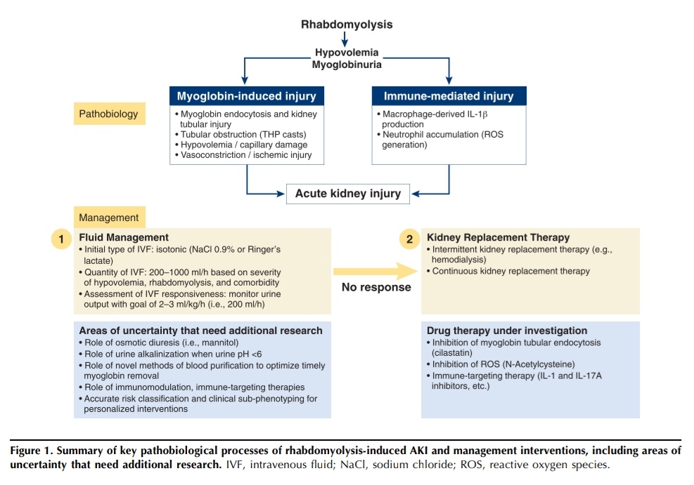 Leo_Santo5's tweet photo. 💎Cómo Tratar la Lesión Renal Aguda por Rabdomiolisis ❓🤔

🔰📚CJASN 2023

https://t.co/3Nz7XLWtpD

Enlace a Artículo Completo 👇🏼✅🆓https://t.co/xumUMHb5Li https://t.co/CrcwuHahNp