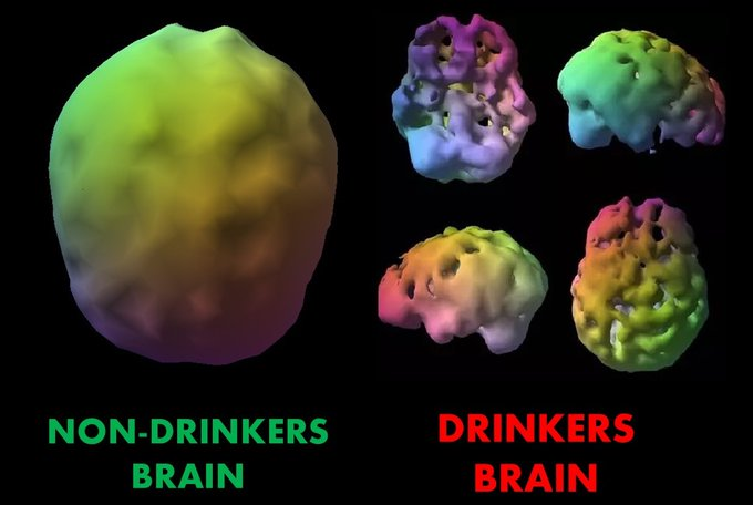 How to fix your dopamine-fried brain permanently.

It all starts with these 7 simple lifestyle switches:

1) Stop Drinking Alcohol.