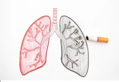 Cigarette smoking 🚬 impairs immune system’s response to infections and promote #inflammation in 🫁 lungs that can lead to or exacerbate chronic respiratory diseases #CRD, the third leading cause of death worldwide. 

People with CRD are more susceptible to influenza infections