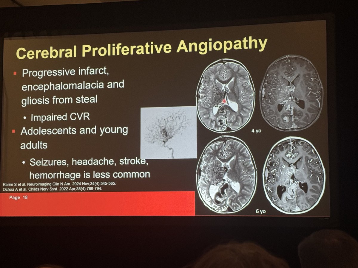 American Society of Pediatric Neuroradiology tweet media