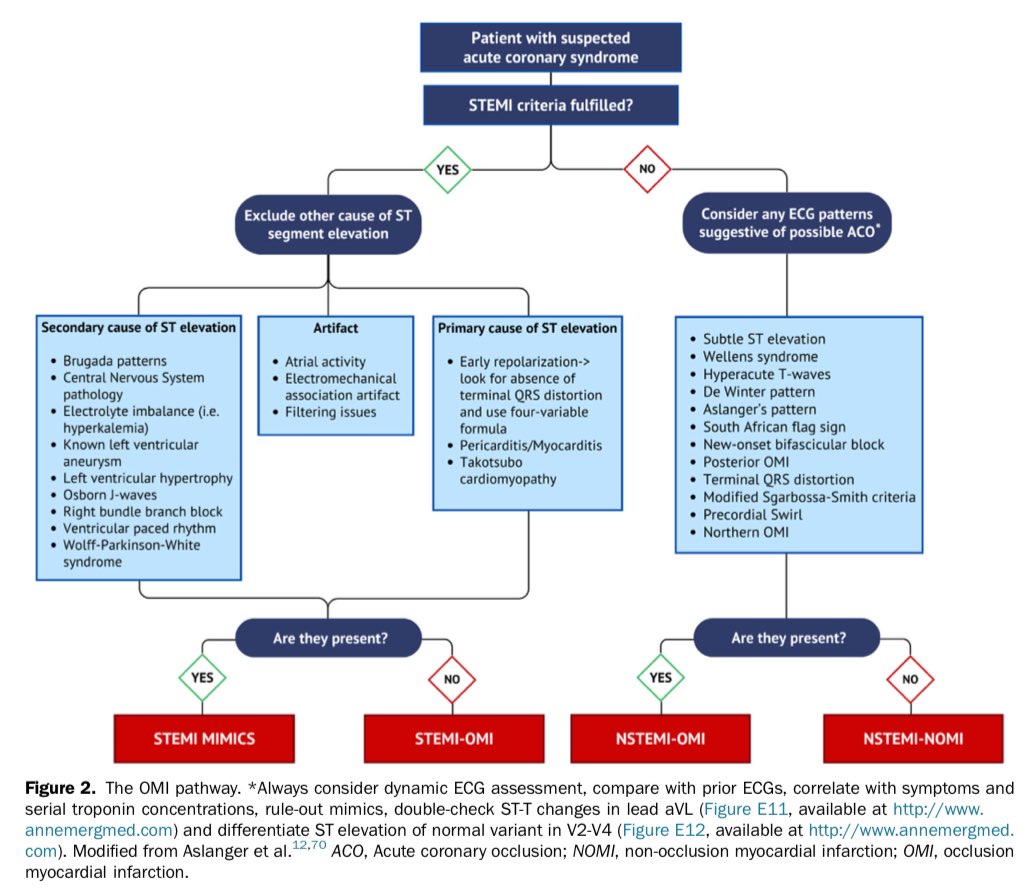 Edgardo Alania (@ed_alania) on Twitter photo 🎯 ECG Patterns of Occlusion Myocardial Infarction: A Narrative Review #ECG #Cardiology #CardioEd #FOAMed #EKG <a href="/smithECGBlog/">Stephen W. Smith</a> #ENARM 🎯 ECG Patterns of Occlusion Myocardial Infarction: A Narrative Review #ECG #Cardiology #CardioEd #FOAMed #EKG <a href="/smithECGBlog/">Stephen W. Smith</a> #ENARM
